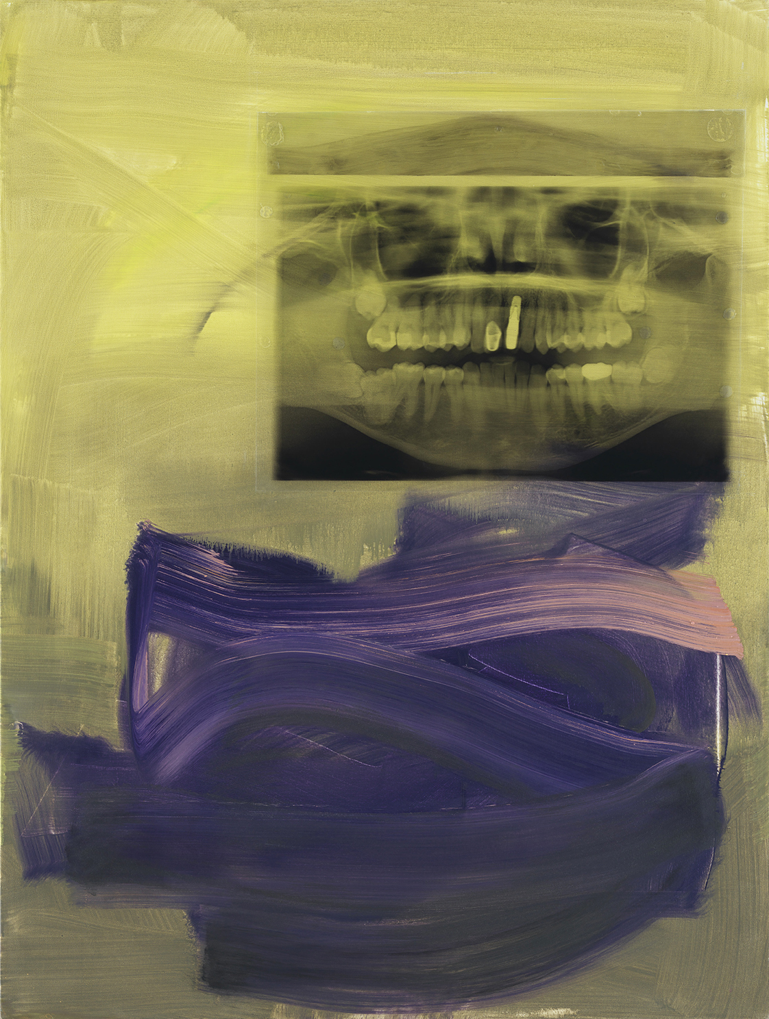 Mary Jones, Dream Screen Patrick